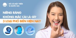 Niềng răng không mắc cài