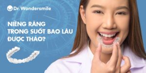 [GIẢI ĐÁP] Niềng răng trong suốt bao lâu được tháo?