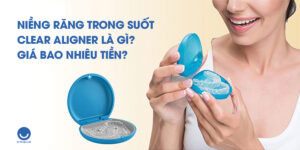 Niềng răng trong suốt Clear Aligner là gì? Giá bao nhiêu?