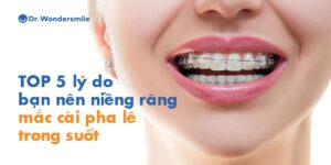 TOP 5 lý do bạn nên niềng răng mắc cài pha lê trong suốt