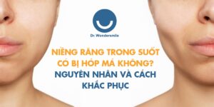 Niềng răng trong suốt có bị hóp má không? Nguyên nhân là gì?