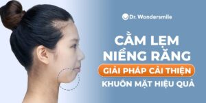 Giải đáp: Cằm lẹm niềng răng có hết hay bớt lẹm không?