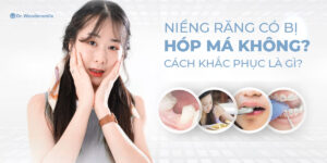 Niềng răng có bị hóp má không? Cách khắc phục là gì?