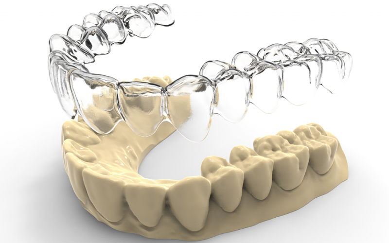 Khay niềng răng sản xuất từ PETG